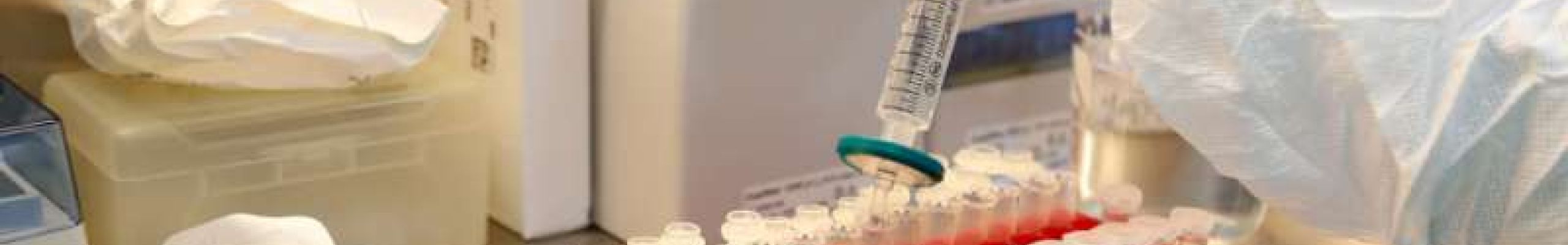 Μελέτη: Η βιταμίνη D ως «σύμμαχος» κατά του κορωνοϊού